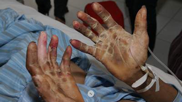 恐怖の料理 豚の血のスープ 感染症で入院相次ぐも人気衰えず 社会 Vietjoベトナムニュース