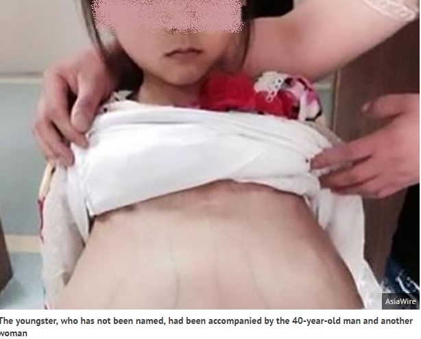 中国で12歳のベトナム人妊婦を保護 人身売買被害者か 三面 Vietjoベトナムニュース