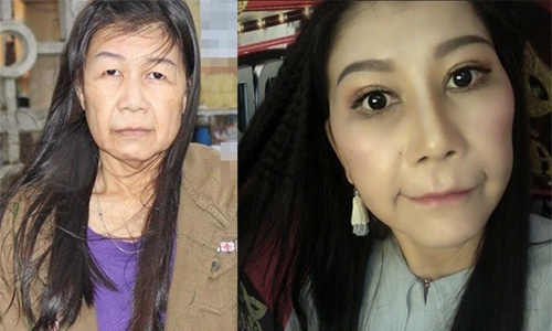 老婆の顔をした22歳女性、整形手術で若返り [三面] VIETJOベトナムニュース
