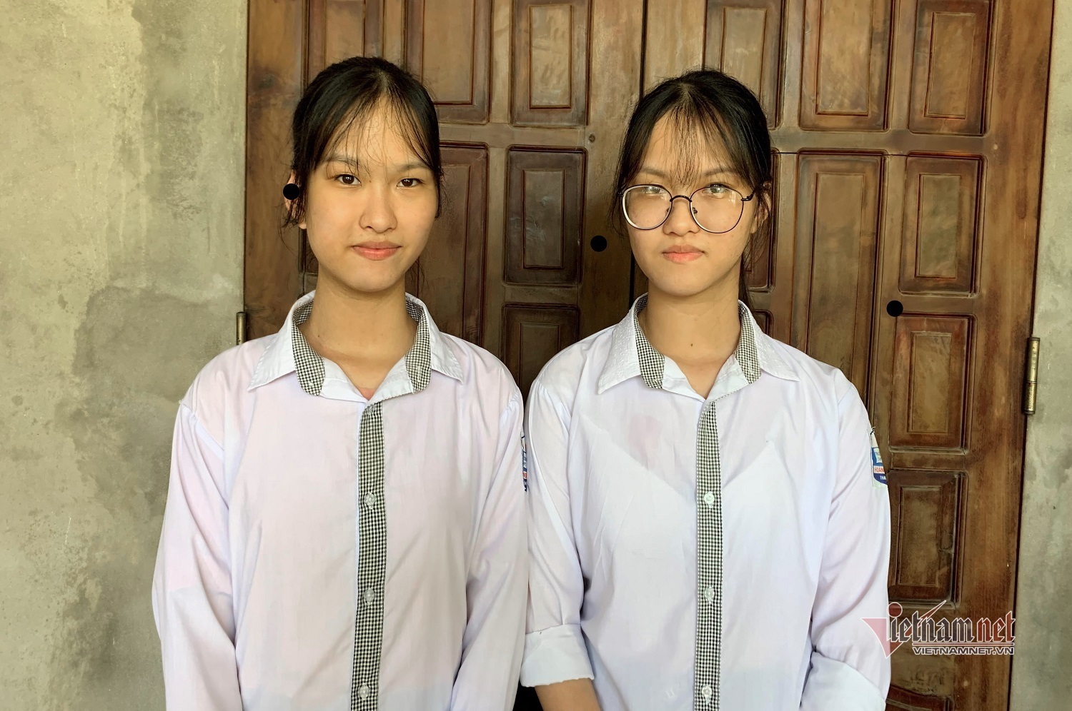 分離手術から17年 大学生になった結合双生児の姉妹 特集 Vietjoベトナムニュース