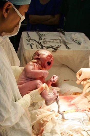 コレクション 中絶赤ちゃん写真 164812