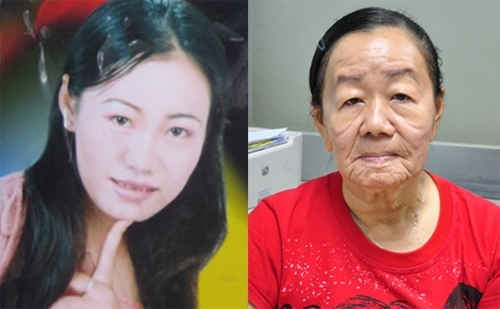 老化病の女性が30歳で死亡 11年に日本メディアで話題 三面 Vietjoベトナムニュース