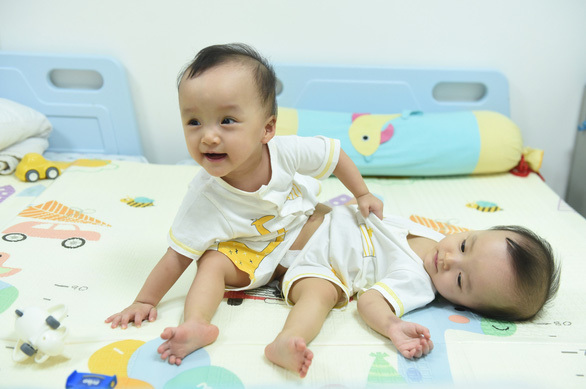 結合双生児の分離手術に成功 計12時間の大手術 ホーチミン 社会 Vietjoベトナムニュース