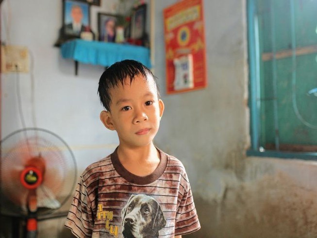 分離手術から7年 結合双生児の片割れを亡くした少年の今 特集 Vietjoベトナムニュース