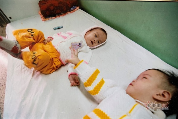 分離手術から17年 大学生になった結合双生児の姉妹 特集 Vietjoベトナムニュース